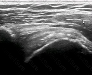 RhMSUS Question 18